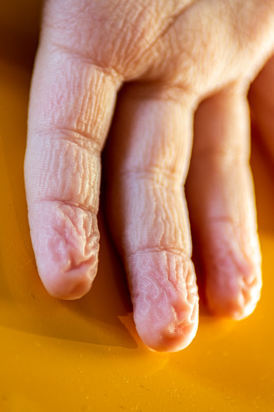 Natural Arthritis Relief: Effective Remedies