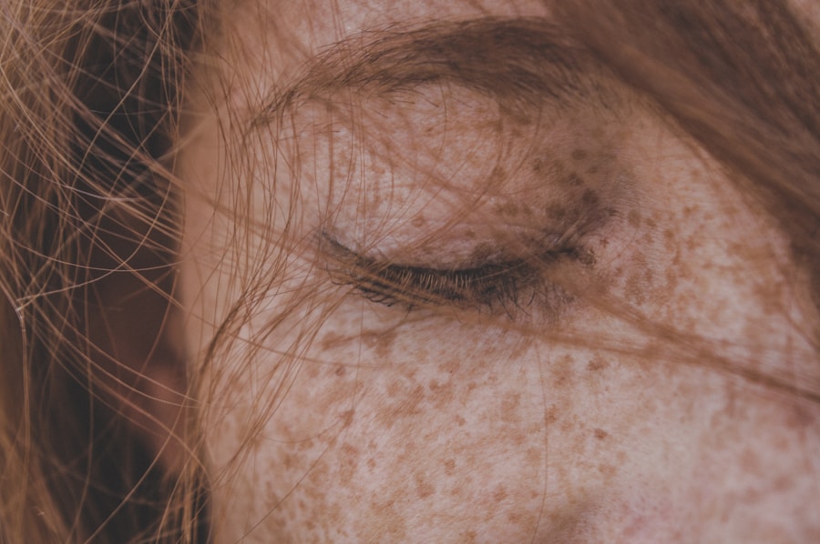 The Link Between Rosacea and Gut Health
