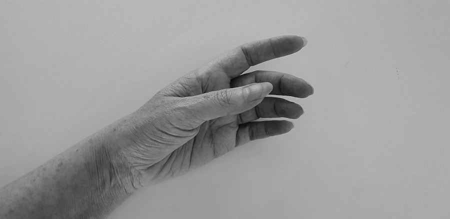 Time-Tested Arthritis Remedies: Natural Relief for Joint Pain