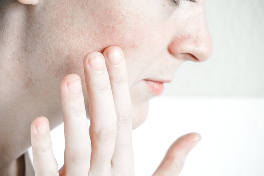 Skin Deep: The Impact of Gut Health on Your Complexion
